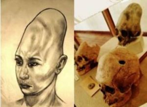 Read more about the article Misterioasele cranii alungite găsite într-o insulă de lângă Alaska. De ce, ulterior, ele au fost ascunse de ochii publicului?